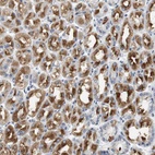 Anti-GRM1 Antibody