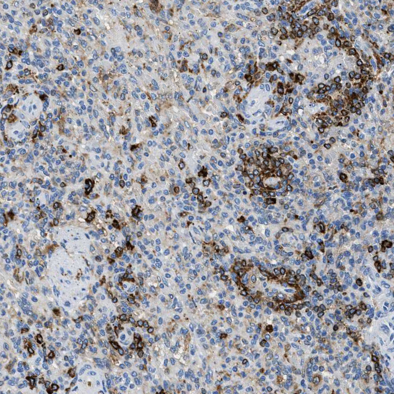 Anti-CD226 Antibody