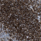 Immunohistochemical staining of human tonsil shows strong positivity in lymphoid cells.