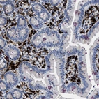 Immunohistochemical staining of human small intestine shows positivity in lymphoid cells.