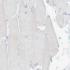 Immunohistochemical staining of human skeletal muscle shows no positivity in myocytes as expected.