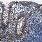 Anti-PDZD8 Antibody