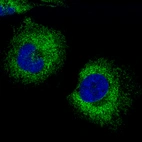Immunofluorescent staining of human cell line RH-30 shows localization to endoplasmic reticulum.