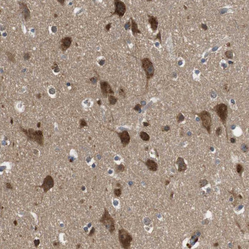 Anti-FAM69A Antibody