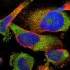 Immunofluorescent staining of human cell line U-251 MG shows localization to cytosol.