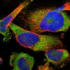 Immunofluorescent staining of human cell line U-251 MG shows localization to cytosol.