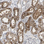 Anti-EVA1C Antibody