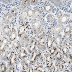 Immunohistochemical staining of human stomach shows strong positivity in Golgi apparatus in glandular cells.