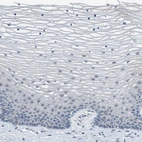 Immunohistochemical staining of human cervix shows no positivity in squamous epithelial cells as expected.