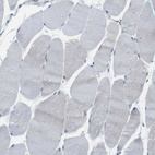 Immunohistochemical staining of human skeletal muscle shows no positivity in myocytes as expected.