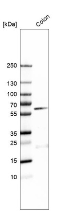 Western blot analysis in human colon tissue.