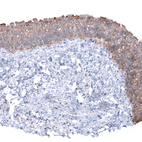 Anti-CDH26 Antibody