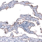 Immunohistochemical staining of human lung shows strong membranous positivity in pneumocytes.