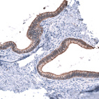 Immunohistochemical staining of human endometrium shows strong membranous positivity in glandular cells.