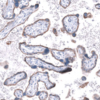 Immunohistochemical staining of human placenta shows strong membranous positivity in trophoblastic cells.