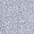 Anti-CDH26 Antibody