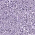 Immunohistochemical staining of human pancreas shows no positivity in exocrine glandular cells as expected.