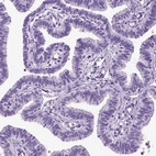 Immunohistochemical staining of human fallopian tube shows no positivity in glandular cells as expected.