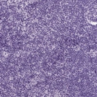 Immunohistochemical staining of human lymph node shows no positivity in non-germinal center cells as expected.