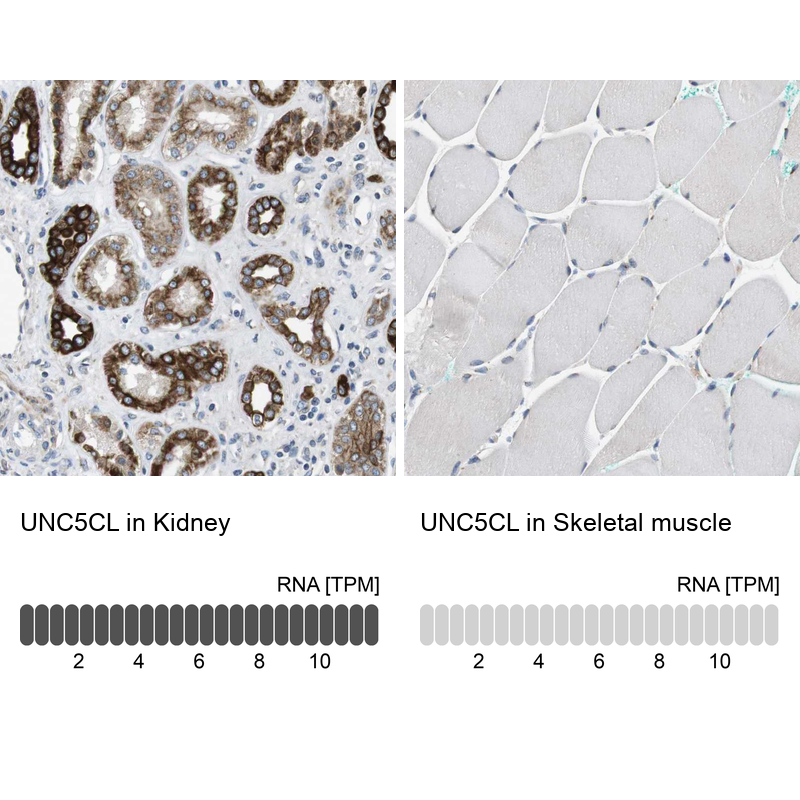 Anti-UNC5CL Antibody