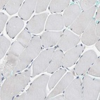 Immunohistochemical staining of human skeletal muscle shows low expression as expected.