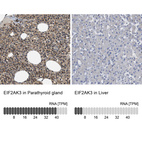 Anti-EIF2AK3 Antibody