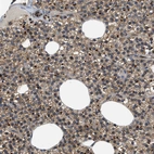 Immunohistochemical staining of human Parathyroid gland shows strong cytoplasmic and membranous positivity in glandular cells.