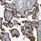 Anti-EIF2AK3 Antibody