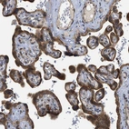 Immunohistochemical staining of human Placenta shows strong cytoplasmic and membranous positivity in trophoblastic cells.