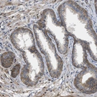 Immunohistochemical staining of human Prostate shows moderate cytoplasmic and membranous positivity in glandular cells.