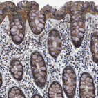 Anti-EIF2AK3 Antibody