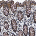 Immunohistochemical staining of human Colon shows moderate cytoplasmic and membranous positivity in glandular cells.