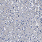 Immunohistochemical staining of human Liver shows very weak cytoplasmic positivity in hepatocytes.
