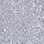 Anti-EIF2AK3 Antibody