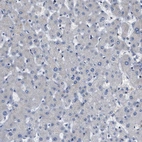 Immunohistochemical staining of human Liver shows very weak cytoplasmic positivity in hepatocytes.
