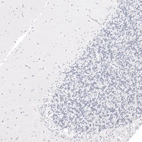 Immunohistochemical staining of human cerebellum shows no positivity in neuronal cells as expected.