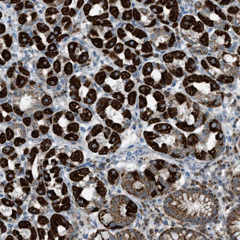 Anti-SRM Antibody