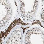 Anti-NEK4 Antibody