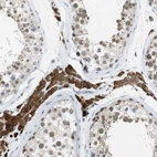 Anti-NEK4 Antibody