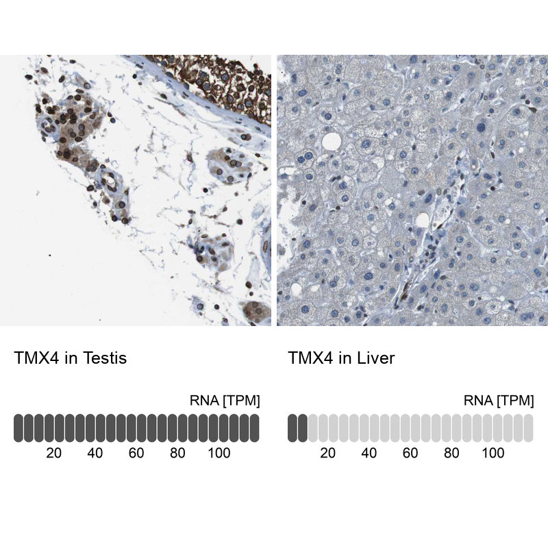 Anti-TMX4 Antibody