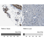 Anti-TMX4 Antibody