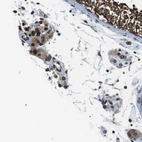 Immunohistochemical staining of human testis shows strong positivity in nuclear membrane in Leydig cells.