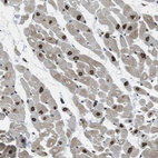 Anti-TMX4 Antibody