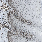 Immunohistochemical staining of human cervix, uterine shows moderate positivity in nuclear membrane in squamous epithelial cells.