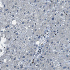 Immunohistochemical staining of human liver shows no positivity in hepatocytes as expected.