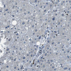 Anti-TMX4 Antibody