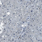 Immunohistochemical staining of human liver shows no positivity in hepatocytes as expected.