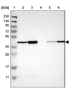 Lane 1: Marker [kDa] 230, 130, 95, 72, 56, 36, 28, 17, 11_br/_Lane 2: Human cell line RT-4_br/_Lane 3: Human cell line U-251MG sp_br/_Lane 4: Human plasma (IgG/HSA depleted)_br/_Lane 5: Human liver tissue_br/_Lane 6: Human tonsil tissue