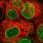 Immunofluorescent staining of human cell line A-431 shows localization to nuclear membrane.