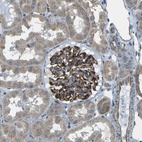 Anti-SLK Antibody